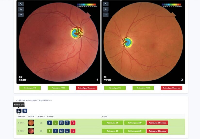 glaucoma-reserach-2024