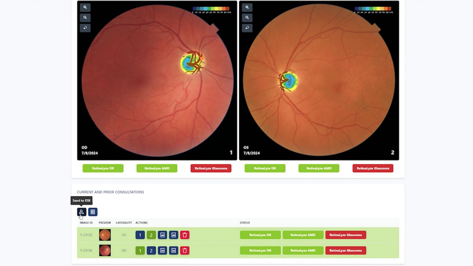 glaucoma-reserach-2024