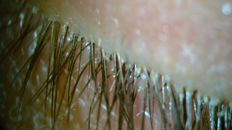 nuzeniec-dr-rowinski